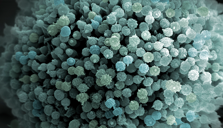 The hidden cost of foodborne illnesses to your business